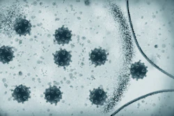Multiplied coronavirus cells seen through microscope.