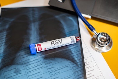 Image of a blood sample with a positive test result for RSV next to a stethoscope and an x-ray.