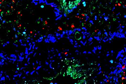 SARS-CoV-2-infected lung cells in mice show nerve- and airway-associated interstitial macrophages (NAMs), which control inflammation, in blue.