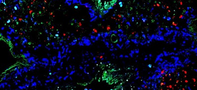 SARS-CoV-2-infected lung cells in mice show nerve- and airway-associated interstitial macrophages (NAMs), which control inflammation, in blue.