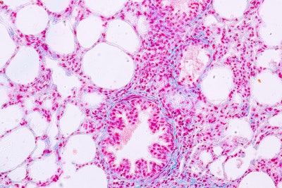 Epithelial Cells
