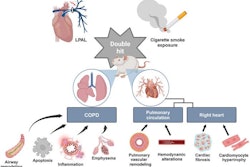 Researchers have developed a novel rat model that closely replicates the pathological features and physiological changes associated with human chronic obstructive pulmonary disease (COPD)-associated cor pulmonale.