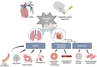 Researchers have developed a novel rat model that closely replicates the pathological features and physiological changes associated with human chronic obstructive pulmonary disease (COPD)-associated cor pulmonale.