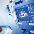 Echocardiogram exam of patient on the display in the ICU
