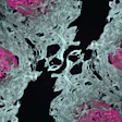 Microscopic view of cellular tissue with gray and pink interconnected structures
