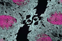 Embryonic mouse lung showing blood vessels (white) and air sacs (pink). This new method to vascularize lung organoids would reduce the reliance on animal models in research.