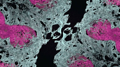 Embryonic mouse lung showing blood vessels (white) and air sacs (pink). This new method to vascularize lung organoids would reduce the reliance on animal models in research.