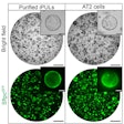 Bright-field and fluorescence images of organoids containing purified iPULs and AT2 cells. Organoids were observed on day 8 in purified iPULs and AT2 cells after the initiation of 3D culture. Scale bar: 1mm (low power) and 100 μm(high power)