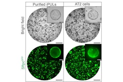 Bright-field and fluorescence images of organoids containing purified iPULs and AT2 cells. Organoids were observed on day 8 in purified iPULs and AT2 cells after the initiation of 3D culture. Scale bar: 1mm (low power) and 100 μm(high power)