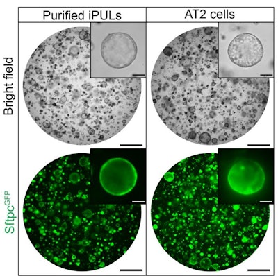 Bright-field and fluorescence images of organoids containing purified iPULs and AT2 cells. Organoids were observed on day 8 in purified iPULs and AT2 cells after the initiation of 3D culture. Scale bar: 1mm (low power) and 100 μm(high power)