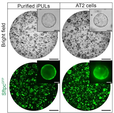 Bright-field and fluorescence images of organoids containing purified iPULs and AT2 cells. Organoids were observed on day 8 in purified iPULs and AT2 cells after the initiation of 3D culture. Scale bar: 1mm (low power) and 100 μm(high power)