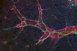 Lymphatic vessels (green) are wrapped around blood vessels (red) in a mouse lung. The PAR1 protein triggers lymphatic vessels to be permeable, so they can absorb more fluid and immune cells for healing—a response distinct from blood vessels, where similar changes result in leakage and disease.