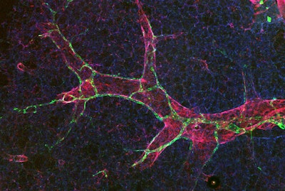 Lymphatic vessels (green) are wrapped around blood vessels (red) in a mouse lung. The PAR1 protein triggers lymphatic vessels to be permeable, so they can absorb more fluid and immune cells for healing—a response distinct from blood vessels, where similar changes result in leakage and disease.