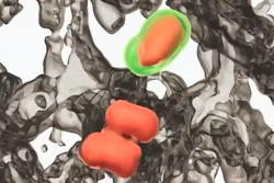 Screenshot of computer image using advanced microscopy to look at lung immune cells causing lung fibrosis.