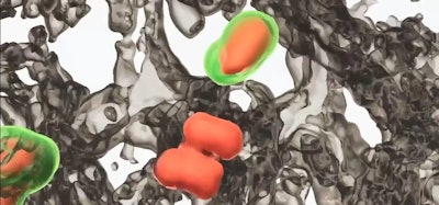 Screenshot of computer image using advanced microscopy to look lung immune cells causing lung fibrosis.