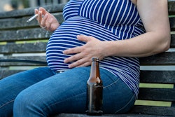 Getty Images 2225072077