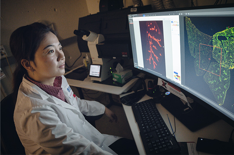 To investigate the potential role of pericytes in pulmonary disease, researcher Ke Yuan, PhD, needed a unique marker to identify the tiny cells.