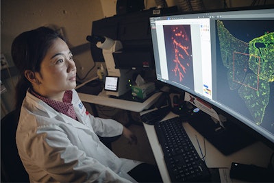 To investigate the potential role of pericytes in pulmonary disease, researcher Ke Yuan, PhD, needed a unique marker to identify the tiny cells.