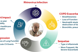 Altesa BioSciences is hoping that its rhinovirus treatment vapendavir can disrupt the cycle of the virus in COPD patients.