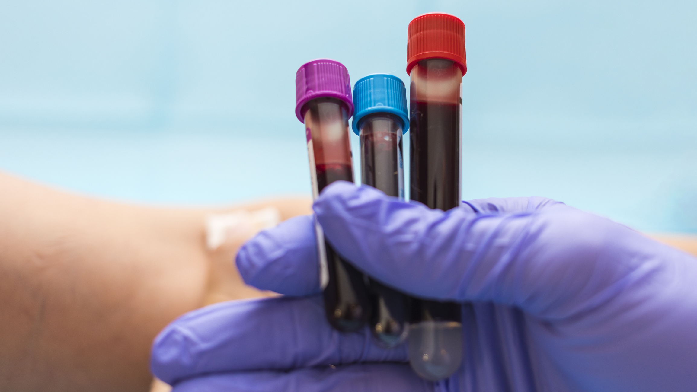 Blood Test2