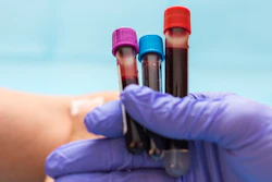 Blood Test2
