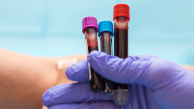 Blood Test2