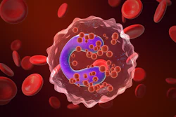 Eosinophil Count