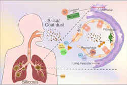 Targeting lung various cells to alleviate pneumoconiosis by suppressing ferroptosis.