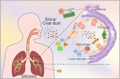 Targeting lung various cells to alleviate pneumoconiosis by suppressing ferroptosis.