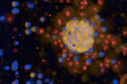 Genetically modified immune cells (CAR-T cells, blue) specifically attack 3D tumor tissue (tumoroids, yellow) and kill tumor cells (visible as dead cells marked in red).