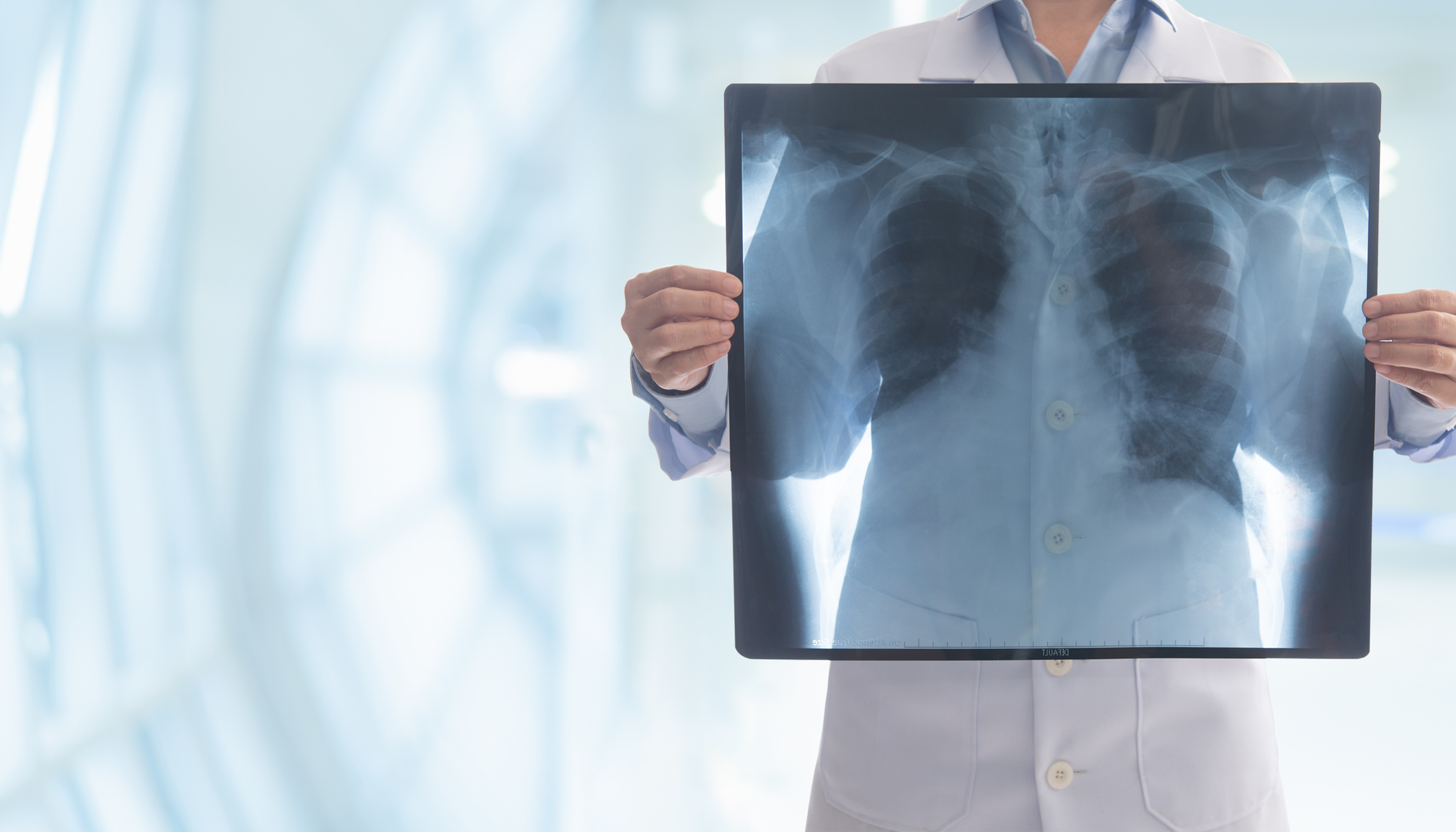 Emphysema Experiment