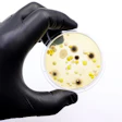 Scientist in black gloves holding petri dish with bacterial colonies growing on yellow agar culture medium