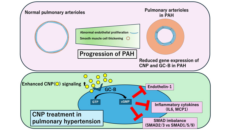 Proposed role of CNP/GC-B signaling in PAH. In PAH, expression of CNP and its receptor GC-B is reduced in the pulmonary vasculature. Endothelial cell-specific CNP or GC-B knockout mice, but not smooth muscle cell-specific GC-B knockout mice, showed more severe PH in mice. Administration of CNP activates endothelial GC-B signaling, which suppresses endothelin-1, inflammatory cytokines and SMAD imbalance, thereby attenuating pulmonary vascular remodeling and disease progression.