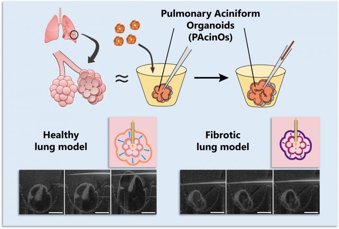 Conceptual illustration comparing the structure of pulmonary aciniform organoids (PAcinOs) with the human pulmonary acinus. Pressure-induced PAcinO expansion mimics the inspiratory motion of alveolar sacs.