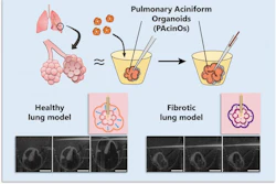 Conceptual illustration comparing the structure of pulmonary aciniform organoids (PAcinOs) with the human pulmonary acinus. Pressure-induced PAcinO expansion mimics the inspiratory motion of alveolar sacs.