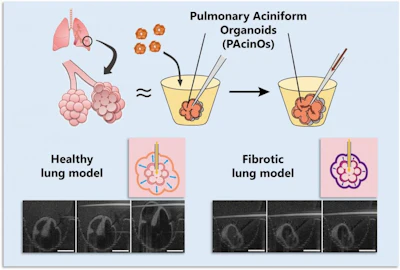 Conceptual illustration comparing the structure of pulmonary aciniform organoids (PAcinOs) with the human pulmonary acinus. Pressure-induced PAcinO expansion mimics the inspiratory motion of alveolar sacs.