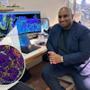 Arutha Kulasinghe, PhD, and non-small cell lung cancer cell