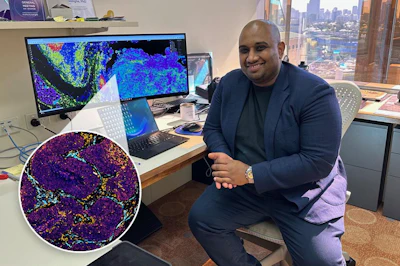 Arutha Kulasinghe, PhD, and non-small cell lung cancer cell