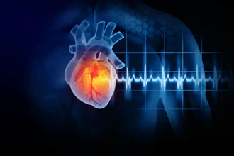 Myocardial Infarction