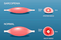 Sarcopenia2
