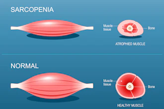 Sarcopenia2