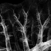 This sample shows muscle wrapped around airway and blood vessel structures close to the outer surface of the fetal lung, which eventually forces the adult heart to work harder in order to properly pump blood.