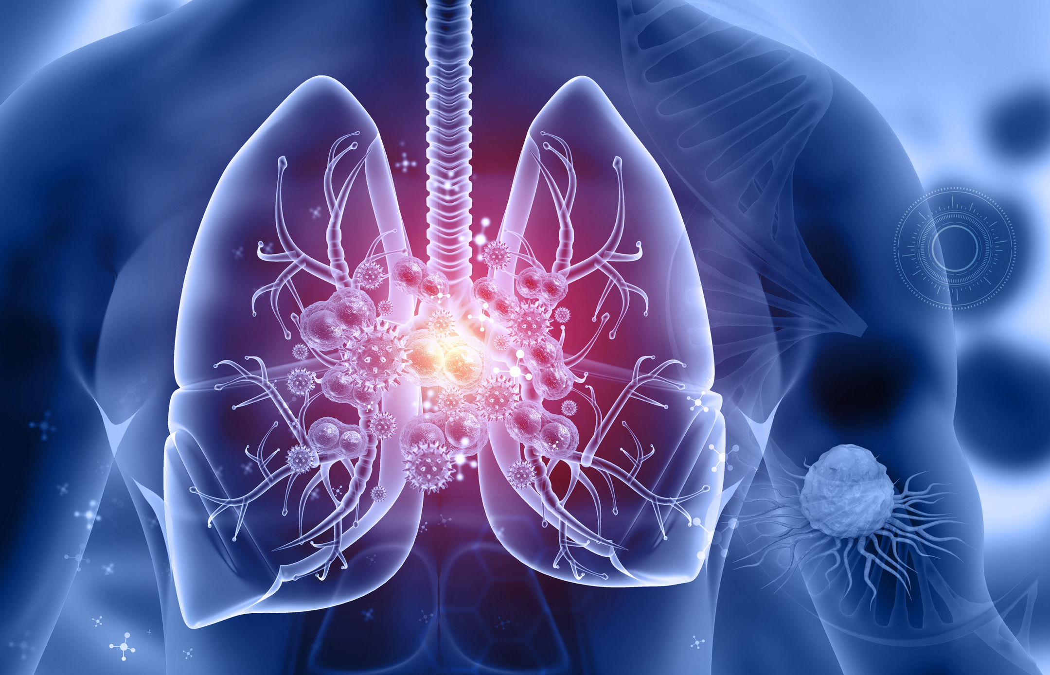 3D medical illustration of lungs showing inflammation and disease with glowing viral particles and branching airways
