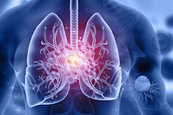 3D medical illustration of lungs showing inflammation and disease with glowing viral particles and branching airways