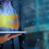 Machine Learning Lungs