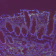 Fluorescent microscopy image showing purple and blue stained tissue structures with cellular organization patterns