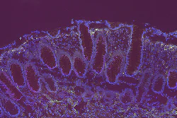 Fluorescent microscopy image showing purple and blue stained tissue structures with cellular organization patterns