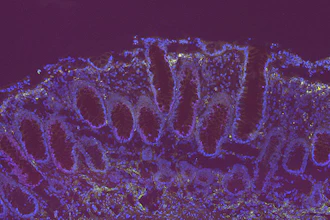 Fluorescent microscopy image showing purple and blue stained tissue structures with cellular organization patterns