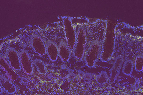 Fluorescent microscopy image showing purple and blue stained tissue structures with cellular organization patterns