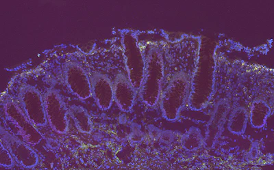 Fluorescent microscopy image showing purple and blue stained tissue structures with cellular organization patterns